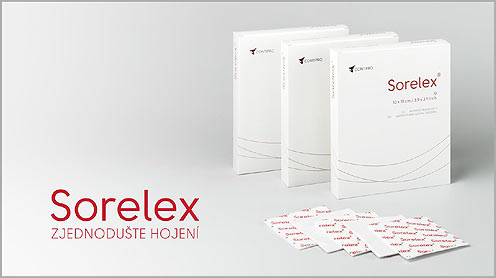 Sorelex esettanulmany 1