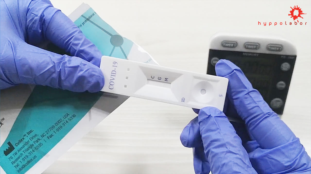 Cellex COVID-19 coronavirus qSARS-CoV-2 IgG/IgM Rapid Test, FDA approved