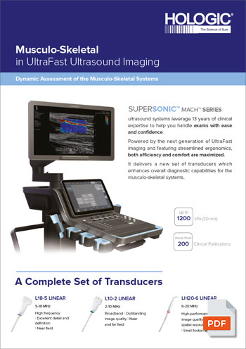 HOLOGIC SUPERSONIC MACH 20