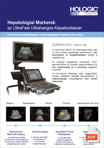 HOLOGIC SUPERSONIC MACH 20